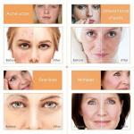 Vitamin C Anti-Aging Skincare Set for Teens