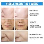 Exfoliating Salicylic Acid Face Pads for Clear Skin