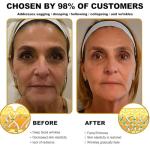 Bee Venom Anti-Aging Cream for Face & Neck