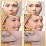 Bee Venom Anti-Wrinkle Cream Duo for All Skin Types