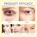 Bee Venom Eye Cream for Dark Circles and Puffiness