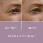 Skinbunny Under Eye Serum for Puffiness and Wrinkles