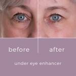 Skinbunny Under Eye Serum for Puffiness and Wrinkles