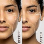 DERMAFLASH Luxe Plus: Anti-Aging Exfoliation Tool