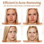 LED Red Light Therapy Mask for Skin Tightening