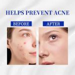 A~313 Vitamin A Retinol Anti-Aging Cream