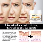 Retinol Collagen Anti-Aging Cream with Hyaluronic Acid