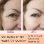 Retinol Collagen Cream for Youthful Skin