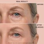 VLYCO Collagen Retinol Eye Cream for Youthful Skin