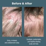 Sea Magik Salicylic Acid Shampoo for Scalp Relief