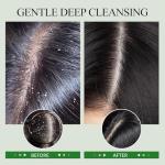 Rosemary Scalp Scrub for Hair Growth & Care