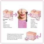 0.5mm Derma Roller for Hair and Skin Care