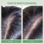 Rosemary Scalp Scrub for Dandruff and Oily Hair