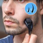 Microneedling Derma-Roller for Hair and Skin