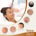 PELCAS 9-Speed Microneedling Pen with Cartridges