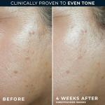 RoC Multi Correxion Anti-Aging Face Moisturizer SPF 30