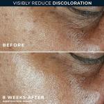 RoC Multi Correxion Anti-Aging Face Moisturizer SPF 30