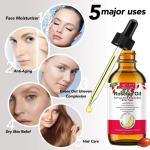 Organic Rosehip Oil for Skin, Hair, and Body
