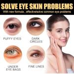 Castor Oil Eye Roller for Dark Circles