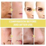 Organic Frankincense Oil for Anti-Aging Skin