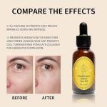 Organic Frankincense & Black Seed Anti-Aging Serum