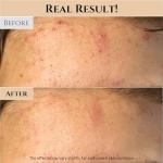Rice and Honey Glow Mask for Healthy Skin