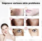 LED Red Light Therapy Face Mask for Anti-Aging