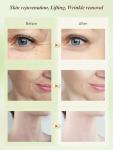 Electric Face Massager for Lifting and Tightening