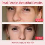 YEOUTH Retinol Eye Cream for Dark Circles & Puffiness