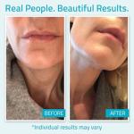 YEOUTH Day and Night Hydrating Face Moisturizer