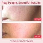 YEOUTH Retinol Cream with Hyaluronic Acid and Green Tea