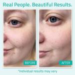 YEOUTH 99% Pure Hydrating Hyaluronic Acid Serum