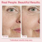YEOUTH Hydrating Retinol Serum with Hyaluronic Acid