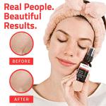 Retinol Hyaluronic Acid Serum for Wrinkles and Dark Spots