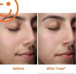 Kate Somerville ExfoliKate Daily Foaming Cleanser