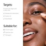 INKEY List Succinic Acid Acne Treatment 15ml