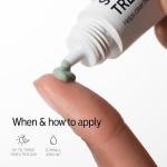 INKEY List Succinic Acid Acne Treatment 15ml