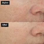 Kiehl's Vitamin C Serum for Youthful Skin
