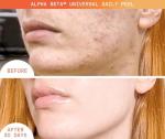 Dr. Dennis Gross Universal Alpha Beta Peel Set