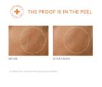 Dr. Dennis Gross Universal Alpha Beta Peel Set