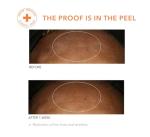 Dr. Dennis Gross Universal Alpha Beta Peel Set