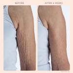 Crépe Erase Advanced Body Repair Treatment - Fragrance Free