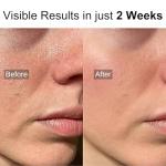 High Strength Retinol Face Serum with Vitamin C