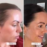 Hair Burst Shampoo and Conditioner Set for Growth