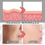 Collagen Boost Anti-Aging Serum with Hyaluronic Acid