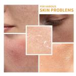 6-Piece Vitamin C Anti-Aging Skincare Set