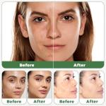 Raw African Black Soap for Acne & Dark Spots