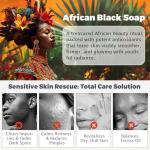 Raw African Black Soap for Acne & Dark Spots