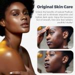 Raw African Black Soap for Acne & Dark Spots