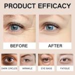 Retinol Eye Cream for Dark Circles & Puffiness